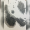 心悸